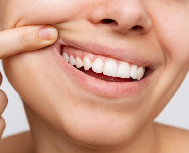 how to get healthy gums