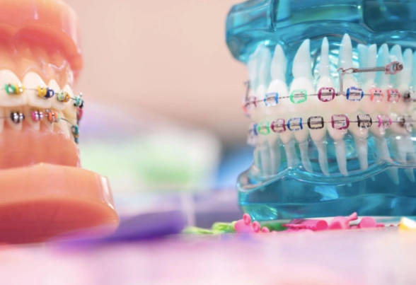 how long does orthodontic treatment take