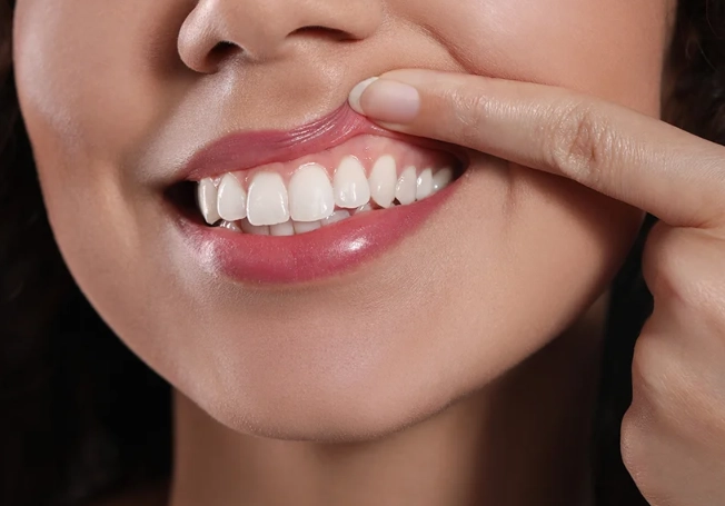 bleeding gums treatment