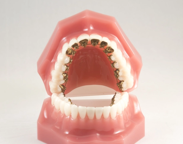 invisible braces for adults