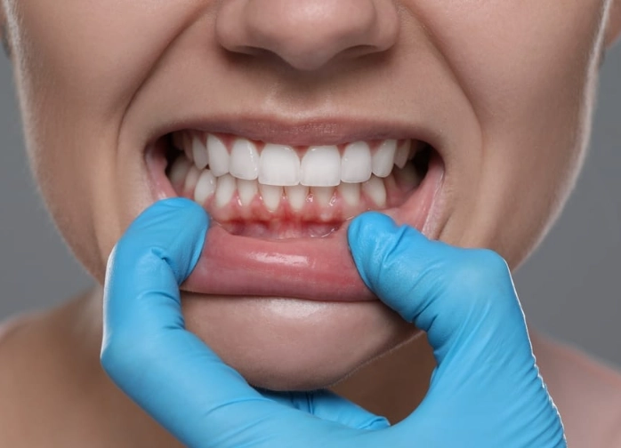 Healthy Gums Tips: A Dentist's Guide to Avoiding Common Mistakes
