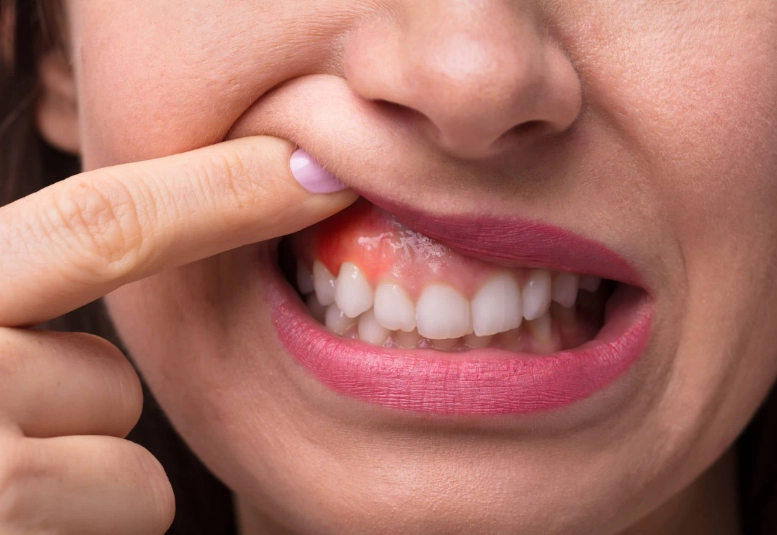 how to stop sensitive teeth pain