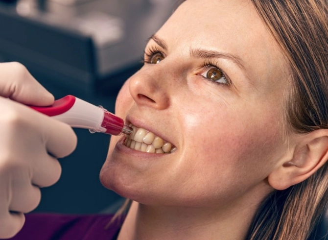 sensitive teeth whitening products