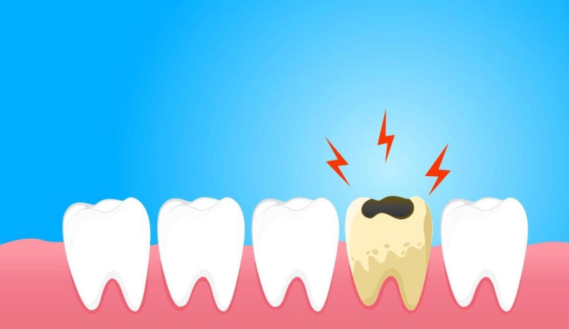 tooth sensitivity and cavities difference tooth sensitivity and cavities difference