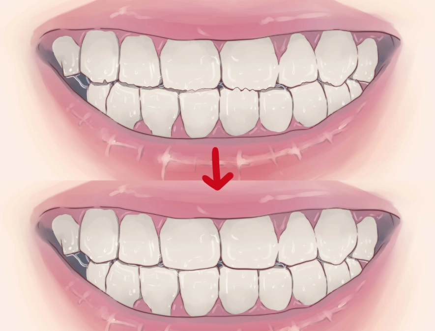 jaw pain from clenching jaw pain from clenching