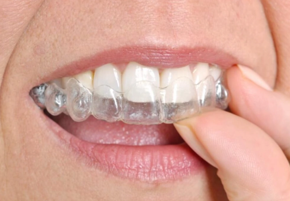 teeth grinding treatment