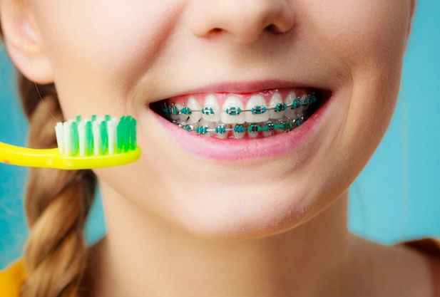 braces care routine