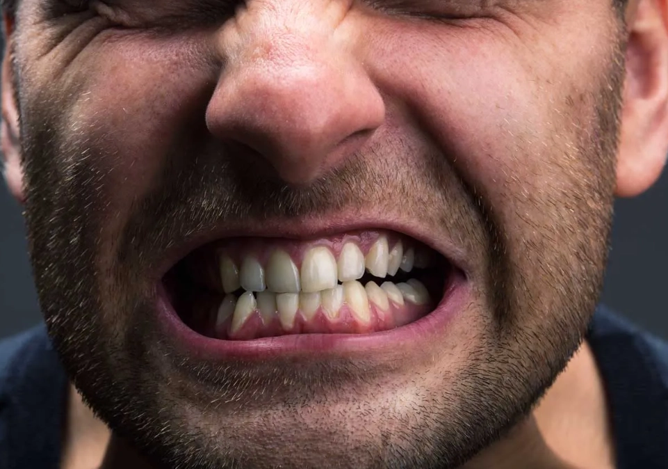 Teeth Grinding at Night: Causes, Damage, and How to Stop