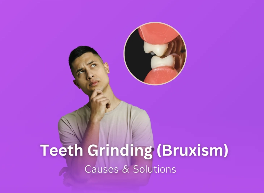 what causes bruxism