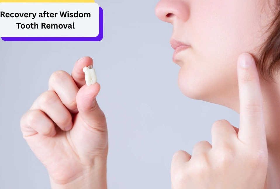 how long does wisdom teeth recovery take