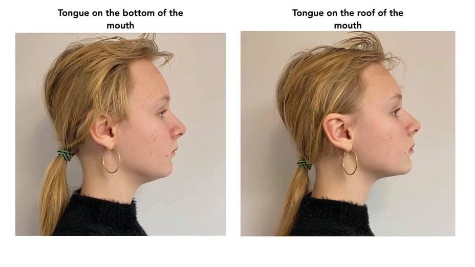 sleeping positions to prevent teeth grinding sleeping positions to prevent teeth grinding