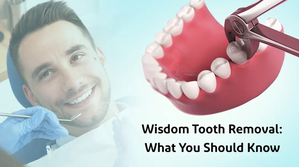 signs you need wisdom teeth out signs you need wisdom teeth out