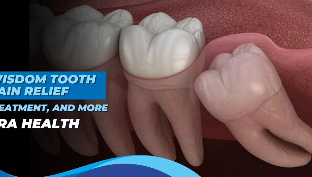 how to stop wisdom tooth pain