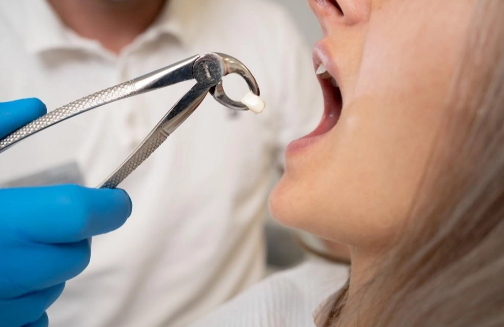 how long does wisdom teeth recovery take how long does wisdom teeth recovery take