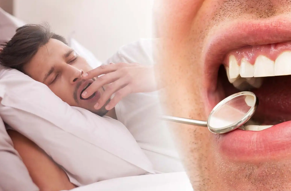 bruxism and sleep disorders bruxism and sleep disorders