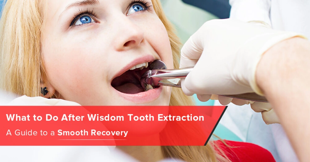 how long does wisdom teeth recovery take how long does wisdom teeth recovery take