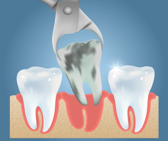 dental surgery dental surgery