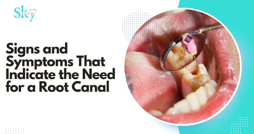 signs of root canal signs of root canal