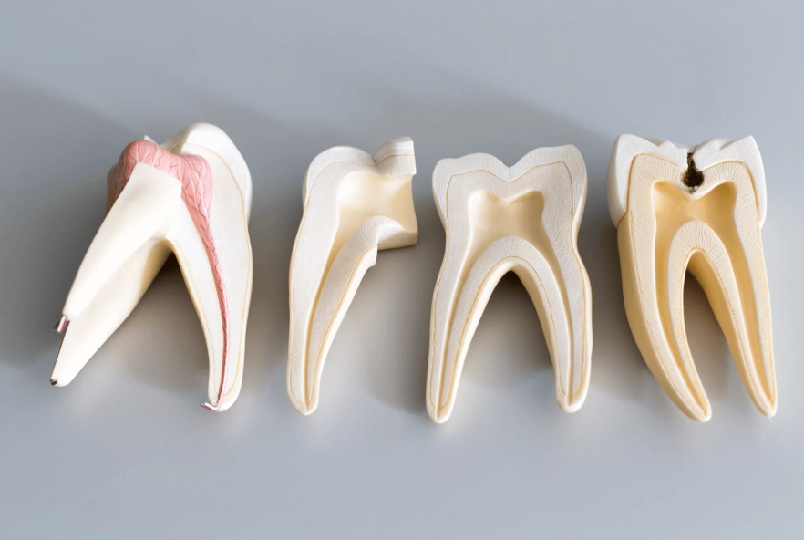 front tooth root canal appearance front tooth root canal appearance