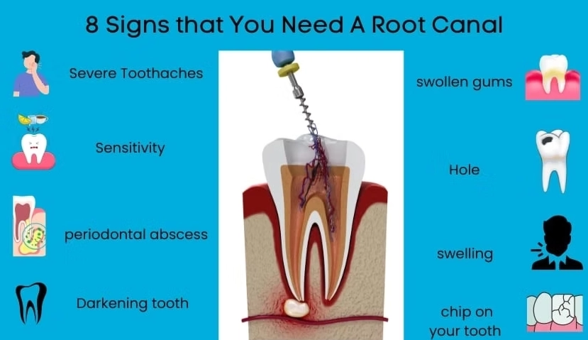 tooth pain root canal tooth pain root canal