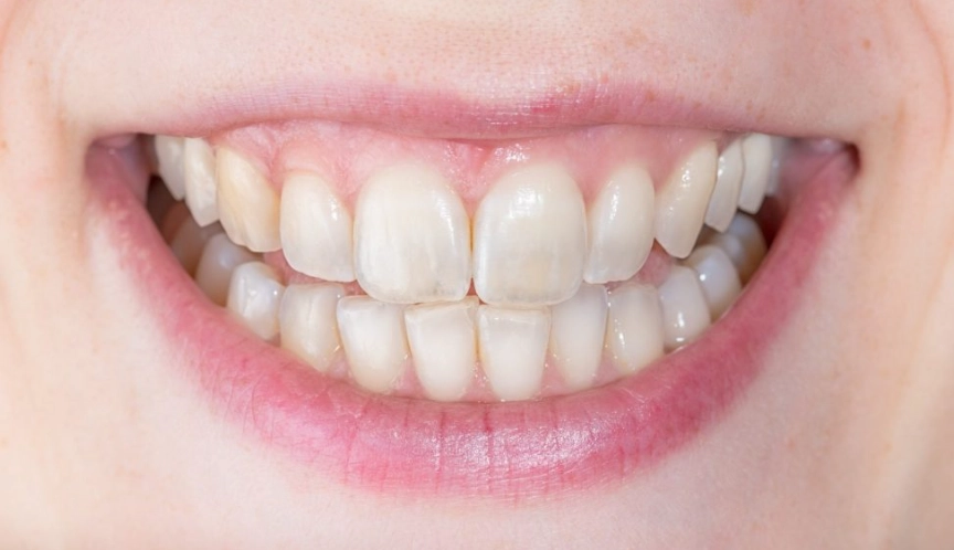 TartarEnd results timeline