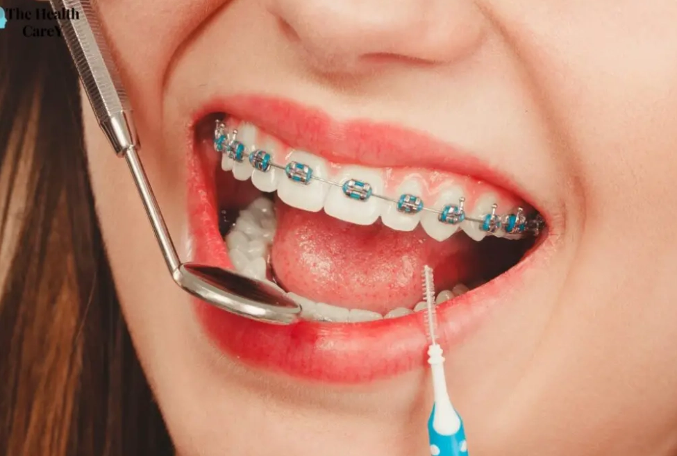 teeth cleaning disadvantages