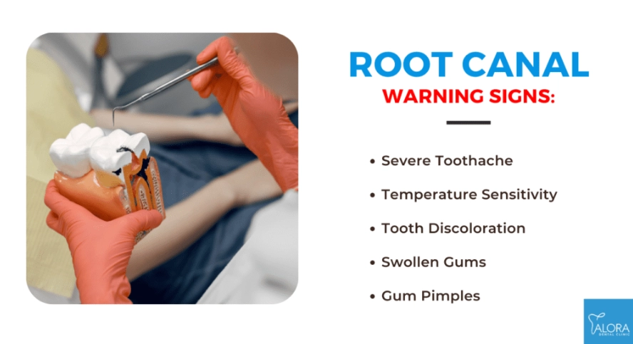 root canal symptoms root canal symptoms