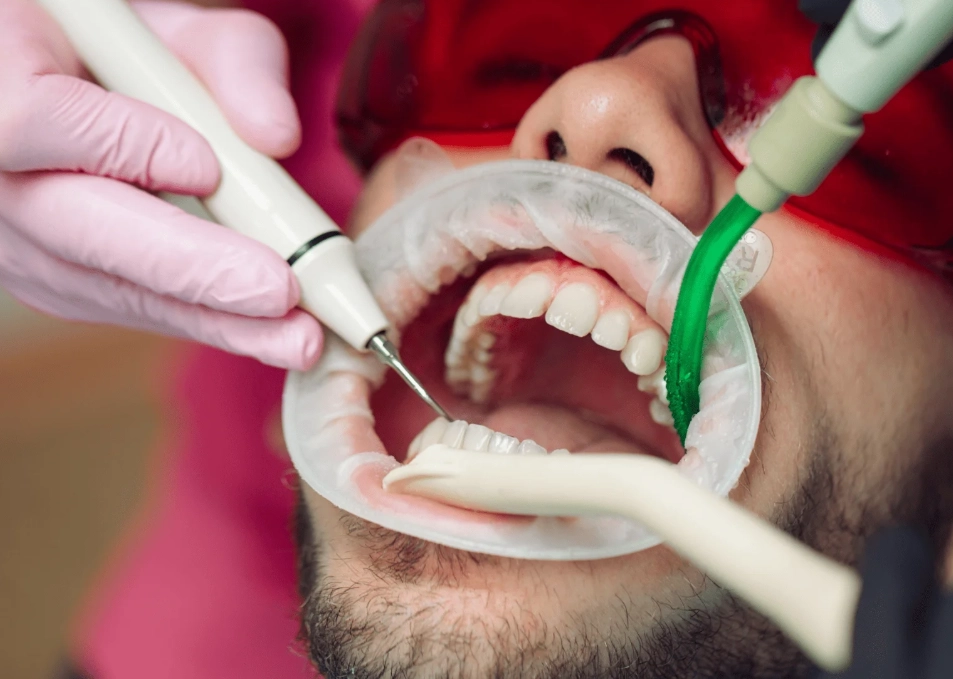 risks of professional teeth cleaning