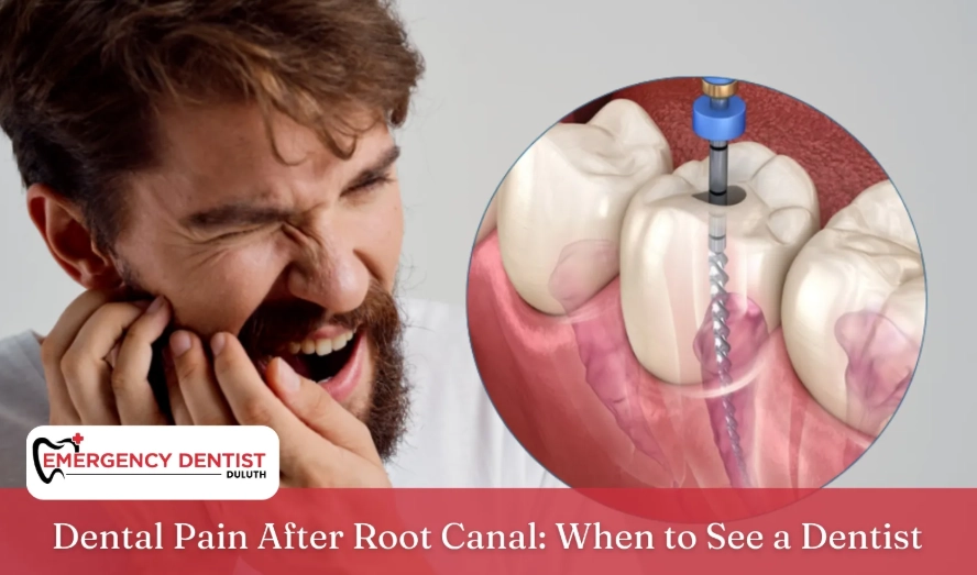 root canal recovery pain root canal recovery pain