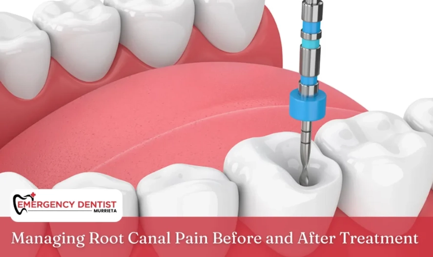 is root canal treatment painful is root canal treatment painful
