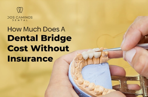 dental bridge cost with insurance
