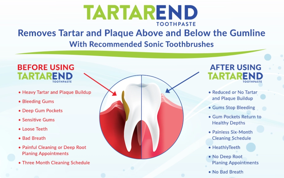 Tartarend toothpaste review