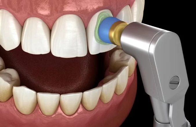 routine dental cleaning