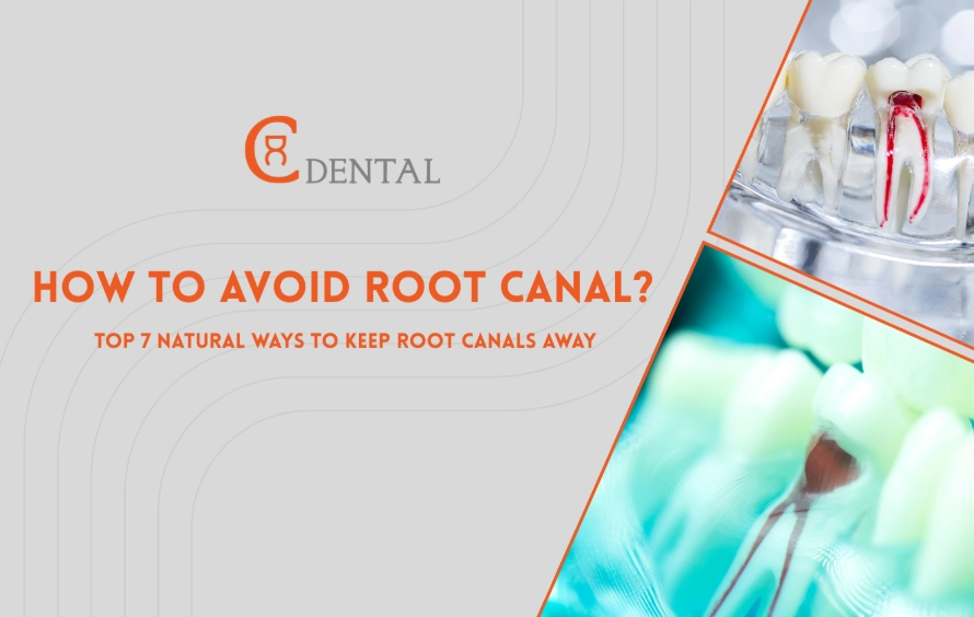 prevent root canal
