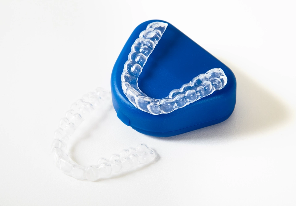 why teeth are yellow after whitening