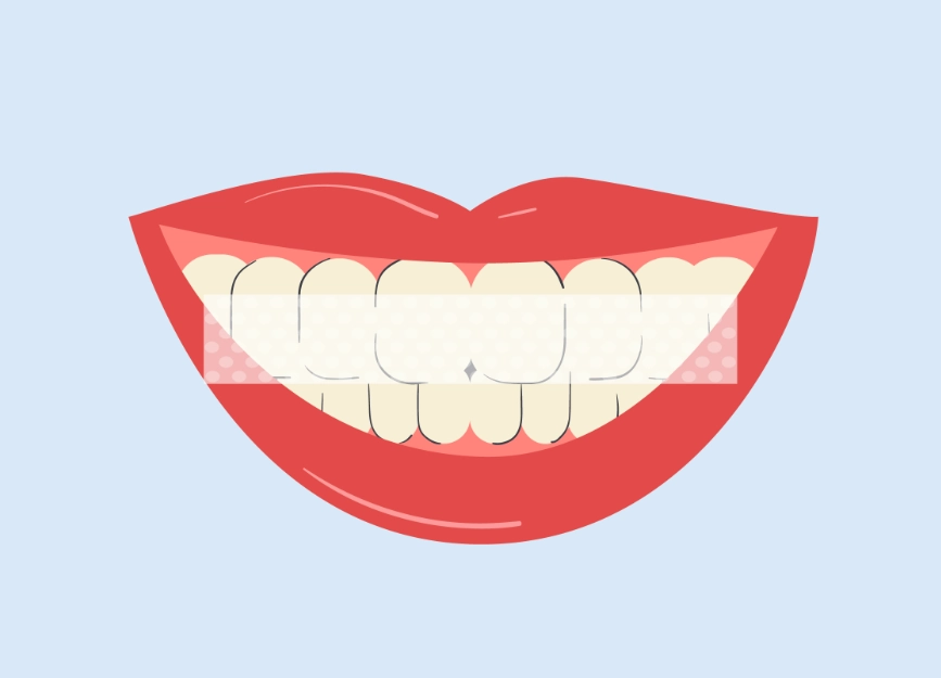 why teeth are yellow after whitening