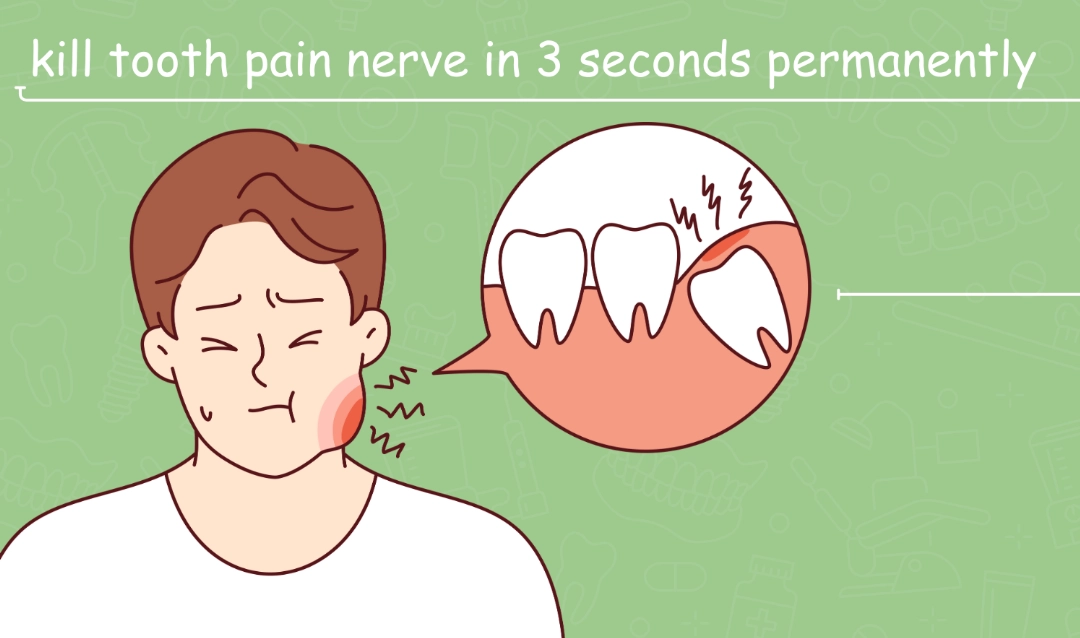 Kill tooth pain nerve in 3 seconds permanently