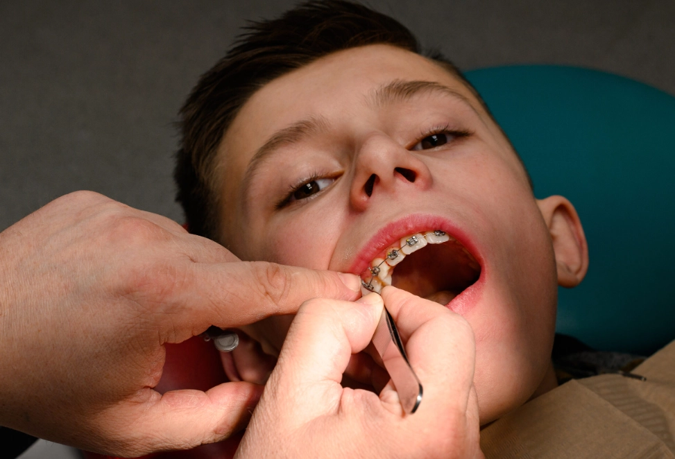 How to relief from tooth pain?