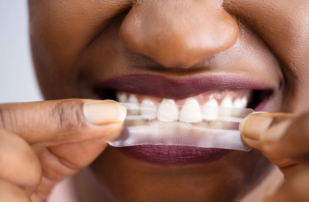 dentist recommended whitening