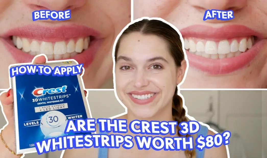 at-home teeth whitening at-home teeth whitening