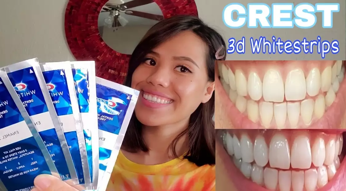 at-home teeth whitening at-home teeth whitening