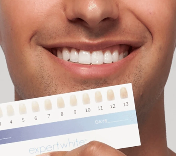 How can I get 100% white teeth?