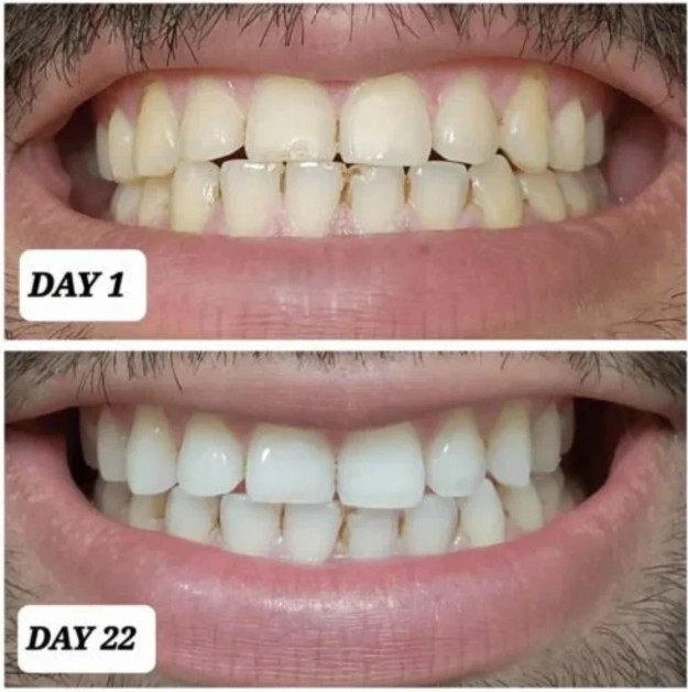 how long do crest whitening strips take to work how long do crest whitening strips take to work