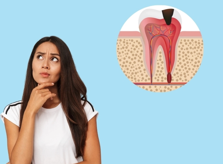 deep tooth decay deep tooth decay