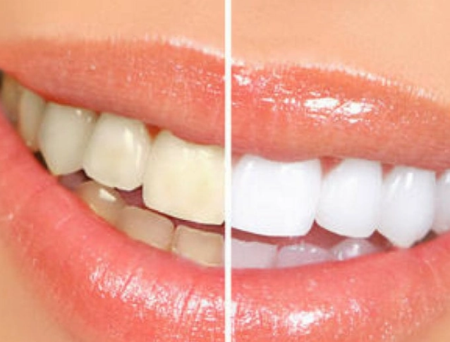 how to whiten teeth naturally how to whiten teeth naturally