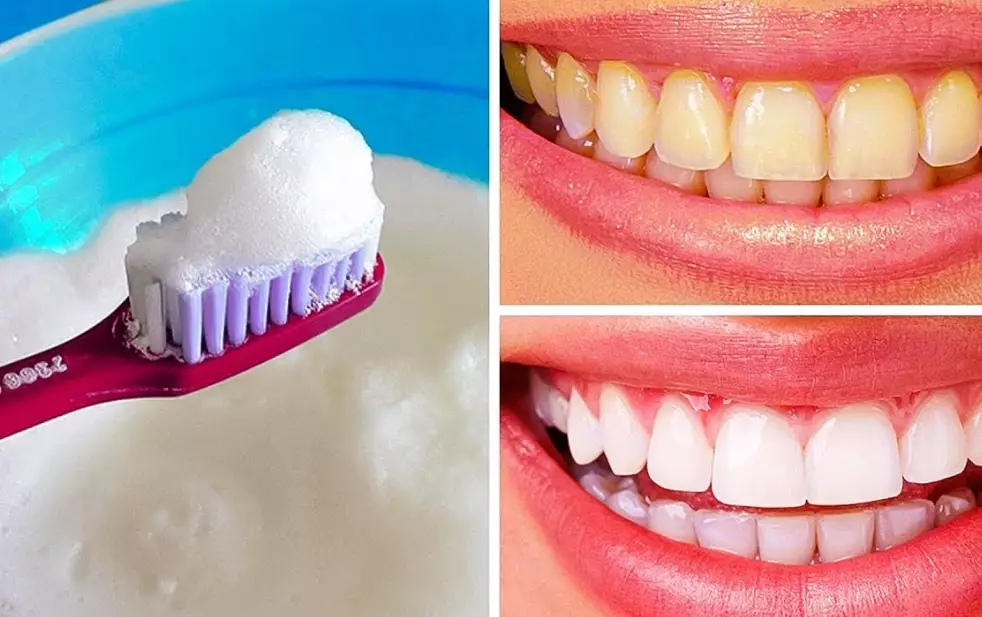 home remedies for white teeth home remedies for white teeth