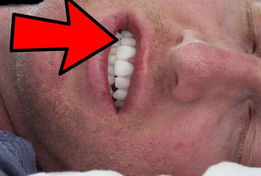 teeth grinding mouth guard teeth grinding mouth guard
