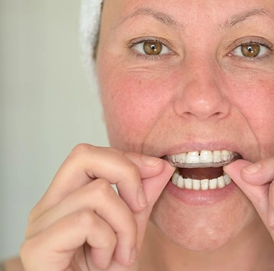 sleep bruxism treatment sleep bruxism treatment