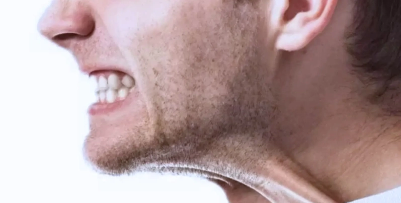 sleep bruxism treatment sleep bruxism treatment