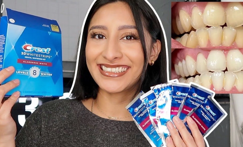 teeth whitening strips immediate results teeth whitening strips immediate results